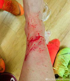 血跡斑斑絲襪,揭開神秘事件的序幕